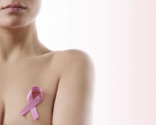 Dépistage génétique du cancer du seinovaire02